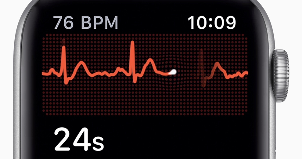 L’apple Watch peut maintenant réaliser un ECG en France